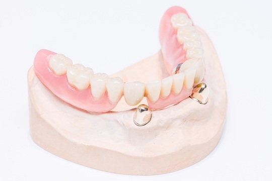 入れ歯（義歯）の治療 - 塚口むらうち歯科矯正歯科クリニック（塚口